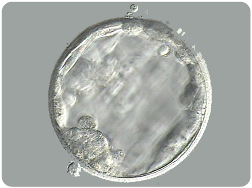 blastocyst